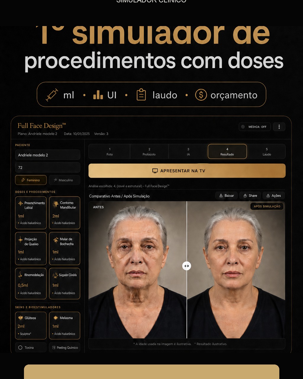 Simulador clínico Face Plan™ com doses, laudo e orçamento na consulta